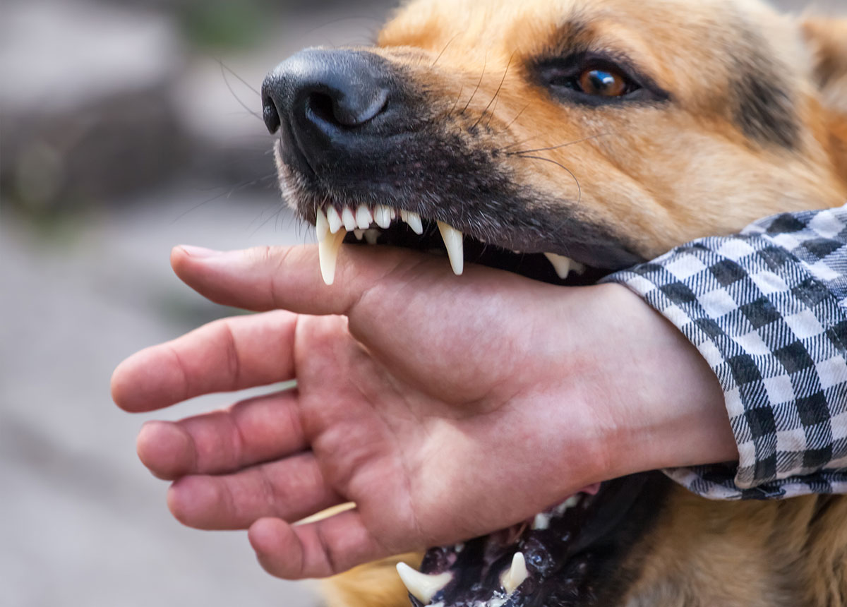Dog Bites